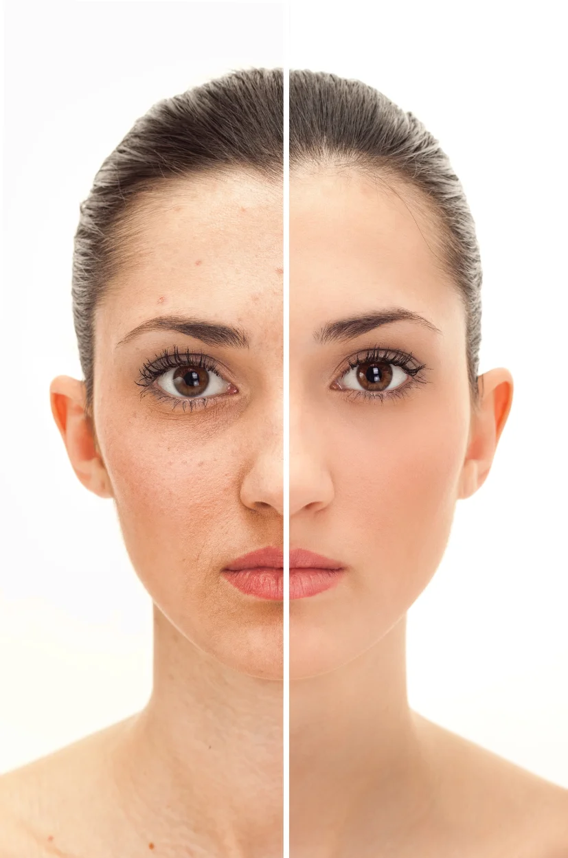 mikrodermabrasion-kosmetikstudio